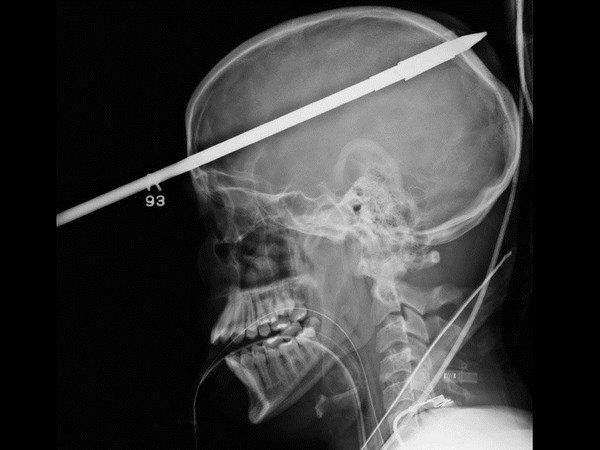 భయనాక ఎక్స్-రేలతో పాటు అల్ట్రా సౌండ్ దృశ్యాలు