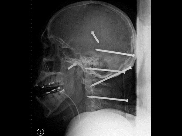 భయనాక ఎక్స్-రేలతో పాటు అల్ట్రా సౌండ్ దృశ్యాలు