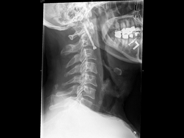 భయనాక ఎక్స్-రేలతో పాటు అల్ట్రా సౌండ్ దృశ్యాలు