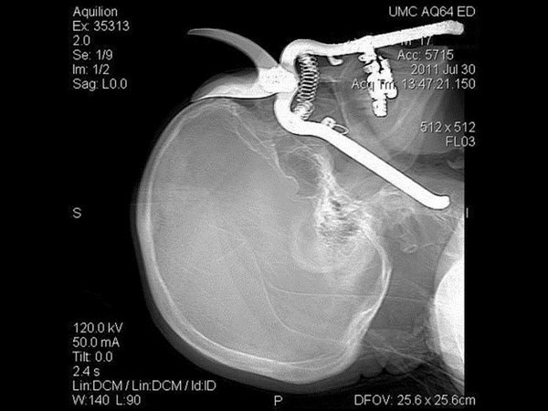 భయనాక ఎక్స్-రేలతో పాటు అల్ట్రా సౌండ్ దృశ్యాలు