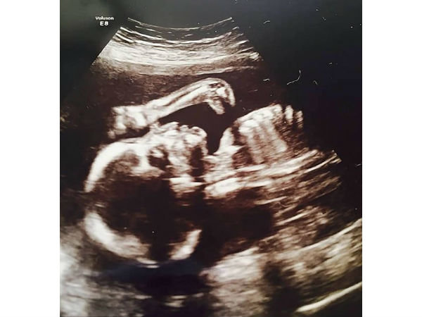 భయనాక ఎక్స్-రేలతో పాటు అల్ట్రా సౌండ్ దృశ్యాలు