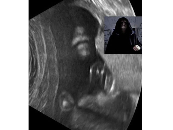 భయనాక ఎక్స్-రేలతో పాటు అల్ట్రా సౌండ్ దృశ్యాలు