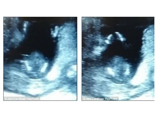 భయనాక ఎక్స్-రేలతో పాటు అల్ట్రా సౌండ్ దృశ్యాలు