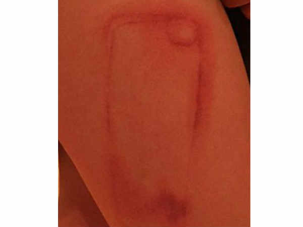 ఫోన్ ప్రొటెక్టివ్ కేస్ నుంచి ప్రమాదకర కెమికల్