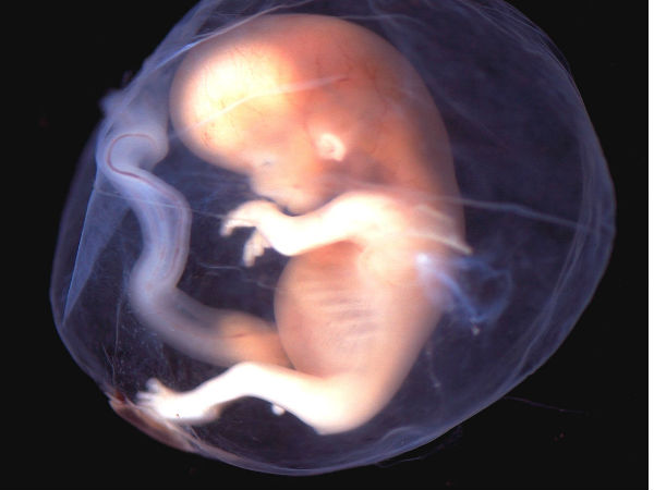 టెక్నాలజీతో ఏం సాధించాం..? ( షాకింగ్ నిజాలు)