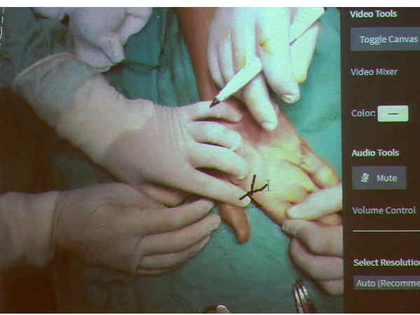 సైన్స్ చరిత్రలో అద్భుతం: ఐ పాడ్‌ను చూస్తూ సర్జరీ చేశారు 