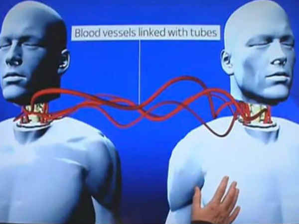 కొత్త ప్రయోగం, ఒకరి తల మరొకరి శరీరానికి