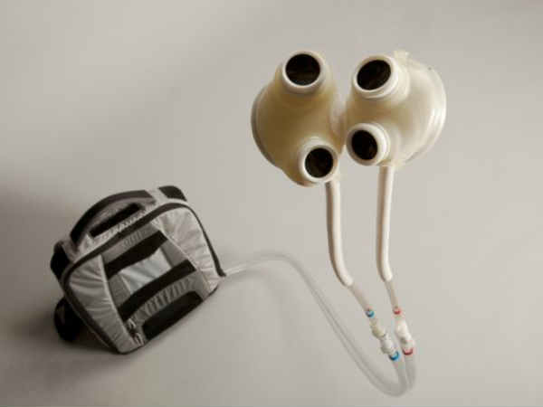 555 రోజులు తన గుండెను బ్యాగ్‌లో పెట్టుకు తిరిగాడు  