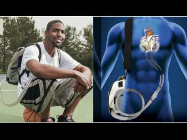 555 రోజులు తన గుండెను బ్యాగ్‌లో పెట్టుకు తిరిగాడు  