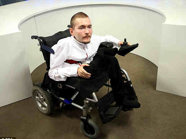  సైన్స్ చరిత్రలోనే షాకింగ్‌ న్యూస్..ఒకరి తలను మరొకరికి.. 