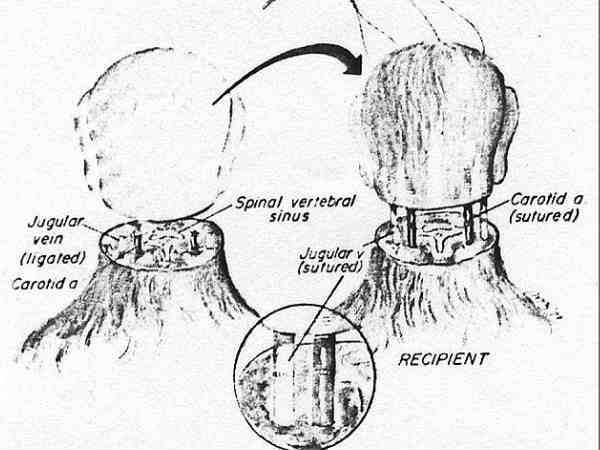 సైన్స్ చరిత్రలోనే షాకింగ్‌ న్యూస్..ఒకరి తలను మరొకరికి.. 