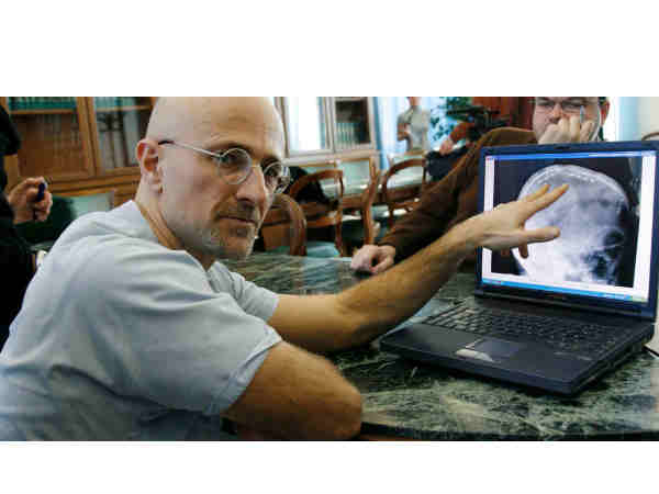 సైన్స్ చరిత్రలోనే షాకింగ్‌ న్యూస్..ఒకరి తలను మరొకరికి.. 