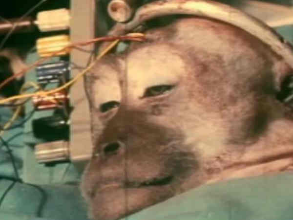 సైన్స్ చరిత్రలోనే షాకింగ్‌ న్యూస్..ఒకరి తలను మరొకరికి.. 