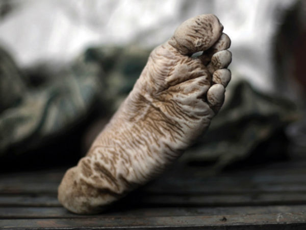 శవ పరీక్షలలో సరికొత్త కోణం!