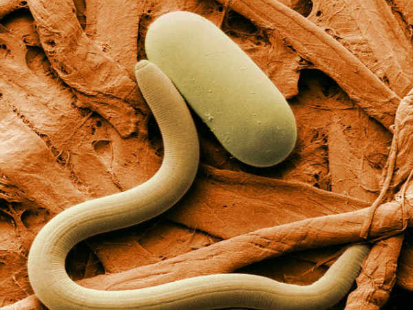 రకరకాల పురుగులు