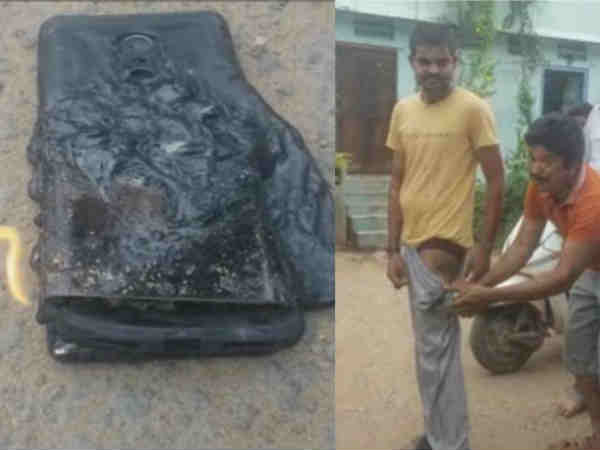 ఫోన్ బ్యాటరీ పేలిపోయిందంటూ..