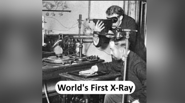 World's First X-RAY 