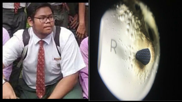 ఆ కుర్రాడి చెవిలోలో నుంచి వస్తున్న రక్తం...