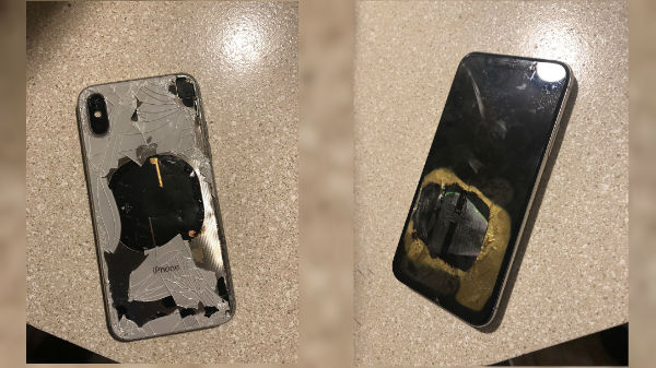 కాలిన గాయపు మచ్చ అలాగే..