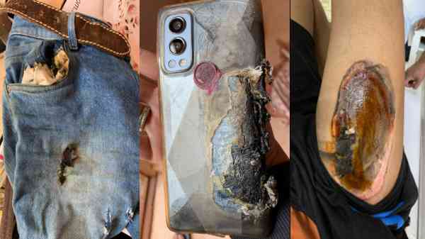 OnePlus Nord 2 5G స్మార్ట్‌ఫోన్ పేలింది