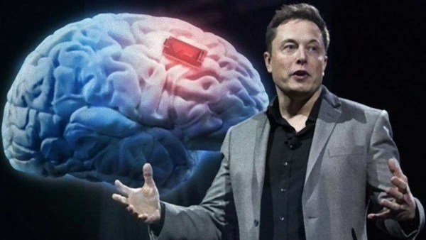 Elon Musk Neuralink Brain Chip Implants Results. 